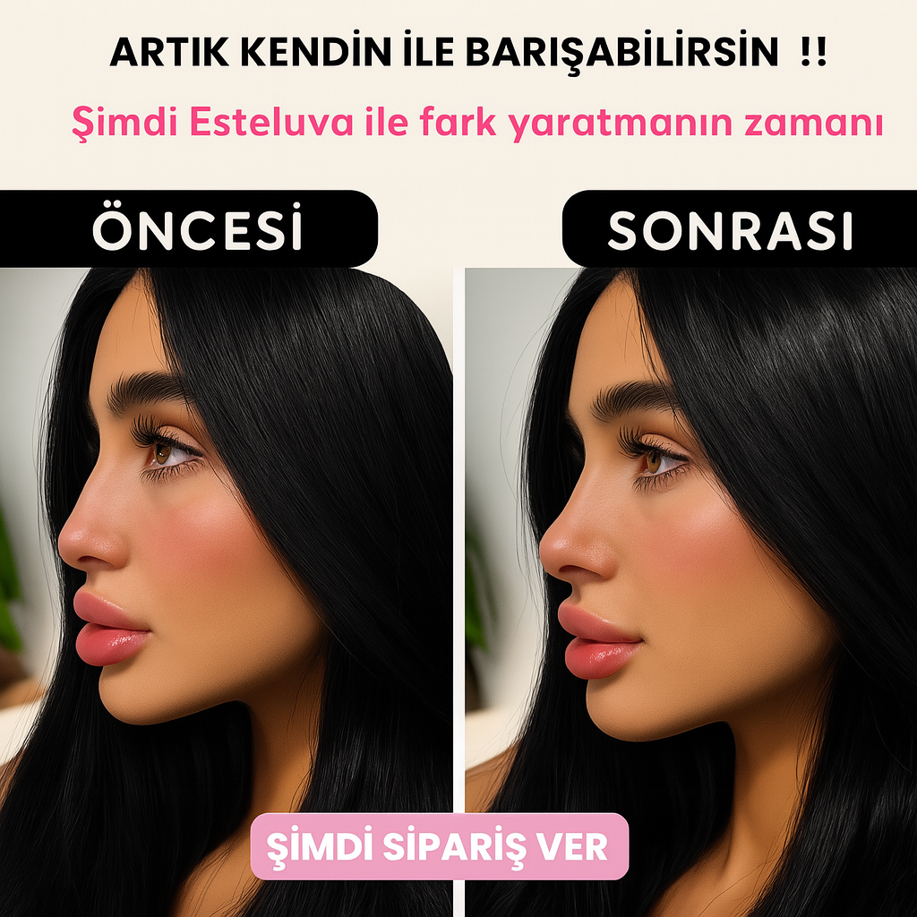 Esteluva™NoseLift